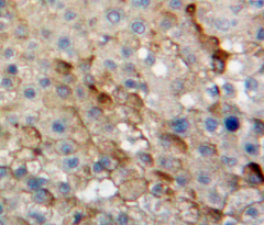 Polyclonal Antibody to Dolichyl Diphosphooligosaccharide Protein Glycosyltransferase (DDOST)