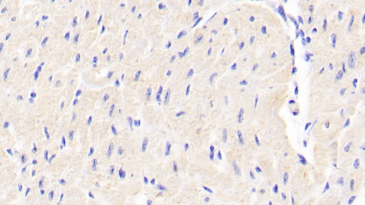 Polyclonal Antibody to D-Aspartate Oxidase (DDO)