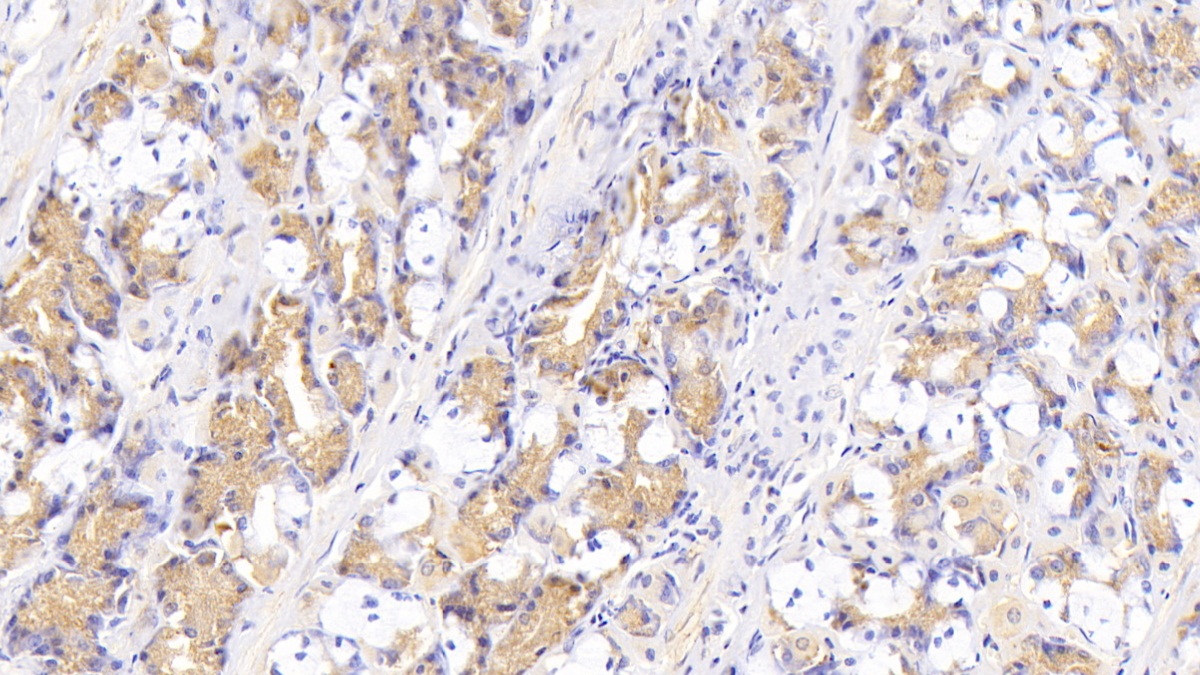 Polyclonal Antibody to D-Aspartate Oxidase (DDO)