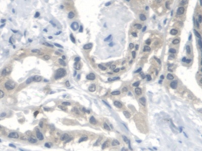 Polyclonal Antibody to Di-N-Acetyl Chitobiase (CTBS)