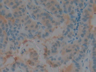 Polyclonal Antibody to Cystatin B (CSTB)