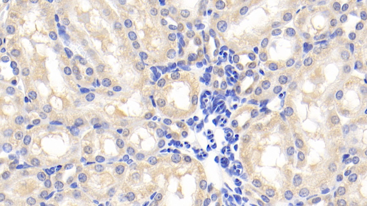 Polyclonal Antibody to Cystatin B (CSTB)