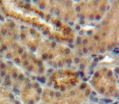 Polyclonal Antibody to Cystatin 5 (CST5)