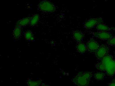 Polyclonal Antibody to Cartilage Associated Protein (CRTAP)