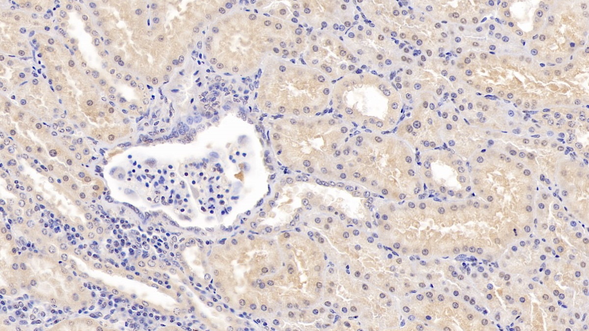 Polyclonal Antibody to Catechol-O-Methyltransferase (COMT)