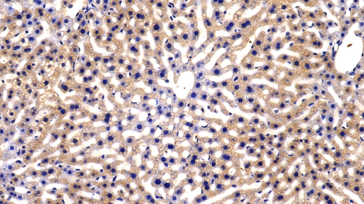 Polyclonal Antibody to Catechol-O-Methyltransferase (COMT)