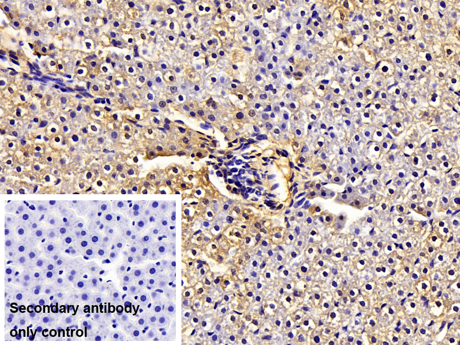 Polyclonal Antibody to Catechol-O-Methyltransferase (COMT)