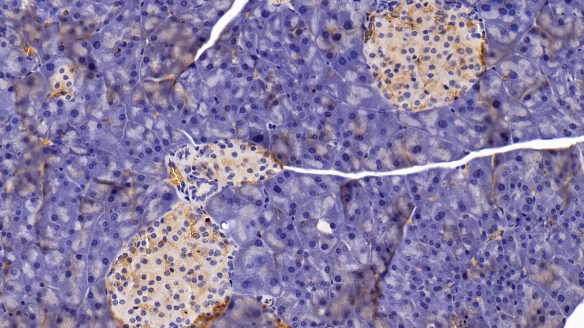 Polyclonal Antibody to Chitinase 1 (CHIT1)