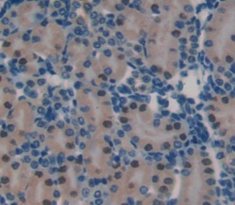 Polyclonal Antibody to Chromatin Assembly Factor 1, Subunit B (CHAF1B)