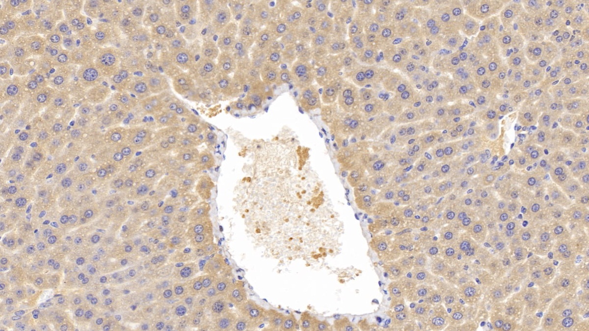 Polyclonal Antibody to Lecithin Cholesterol Acyltransferase (LCAT)