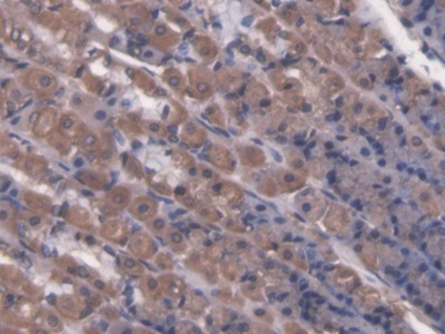 Polyclonal Antibody to Lactase (LCT)