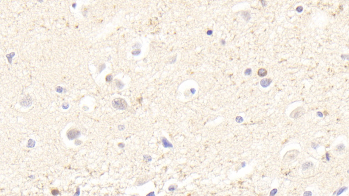 Polyclonal Antibody to Bridging Integrator 1 (BIN1)