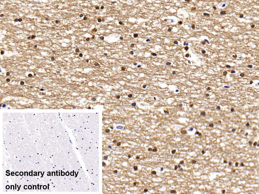 Polyclonal Antibody to Beclin 1 (BECN1)