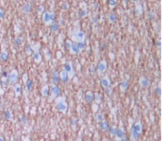 Polyclonal Antibody to BMP And Activin Membrane Bound Inhibitor Homolog (BAMBI)