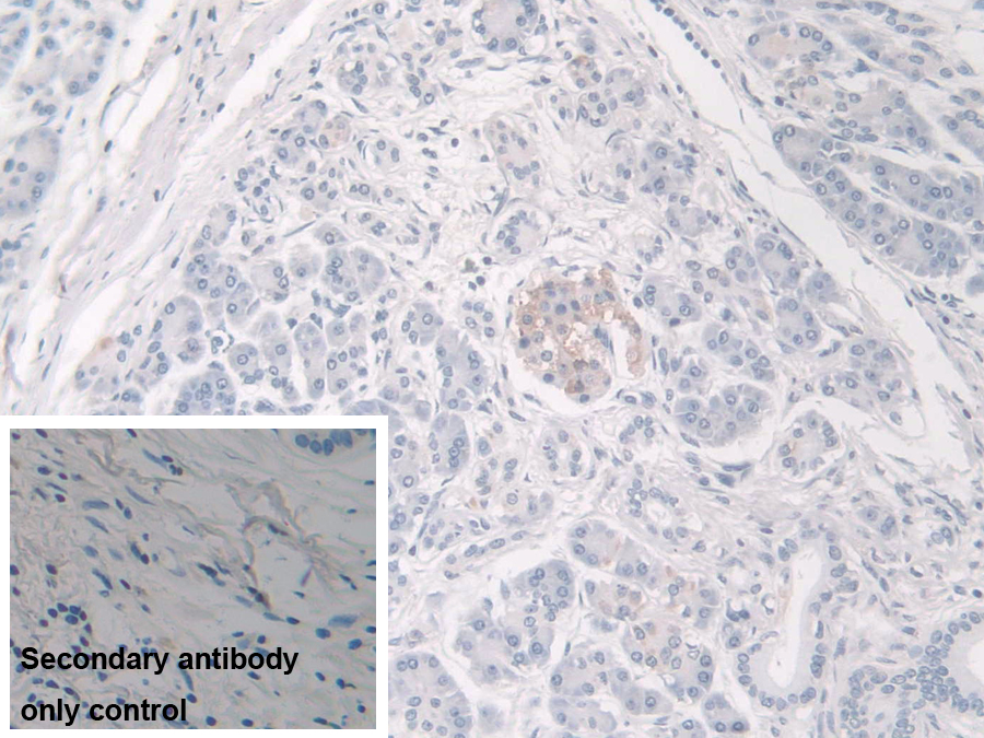 Polyclonal Antibody to Acyloxyacyl Hydrolase (AOAH)