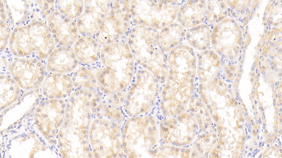 Polyclonal Antibody to Agmatine Ureohydrolase (AGMAT)