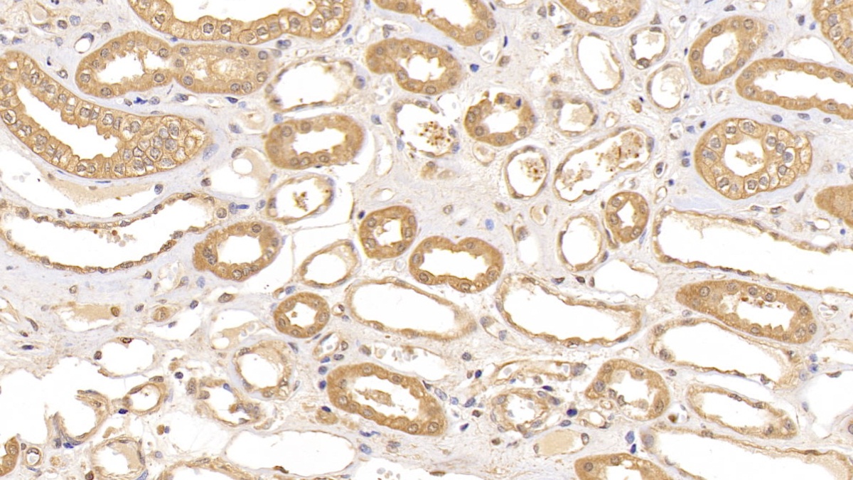 Polyclonal Antibody to Aconitase 1 (ACO1)