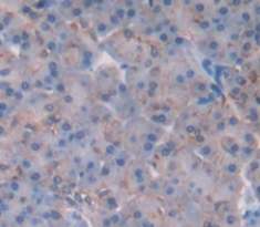 Polyclonal Antibody to H2A Histone Family, Member V (H2AFV)