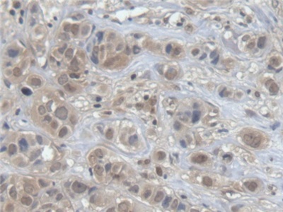 Polyclonal Antibody to MutY Homolog (MUTYH)