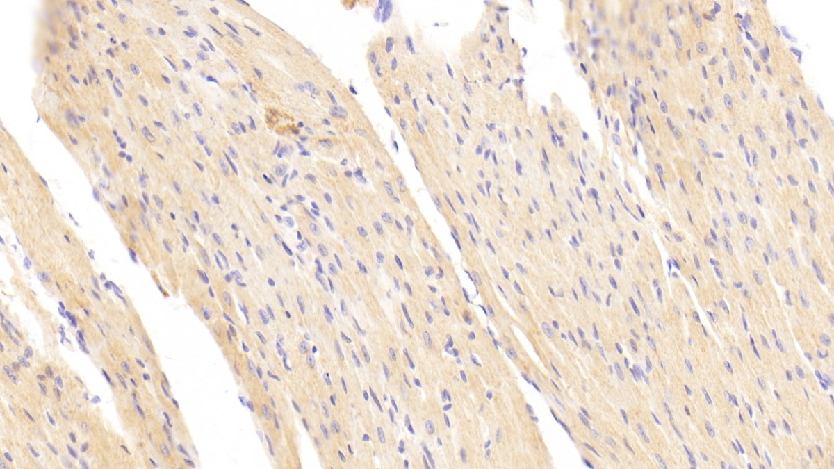 Polyclonal Antibody to Succinate Dehydrogenase Complex Subunit B (SDHB)