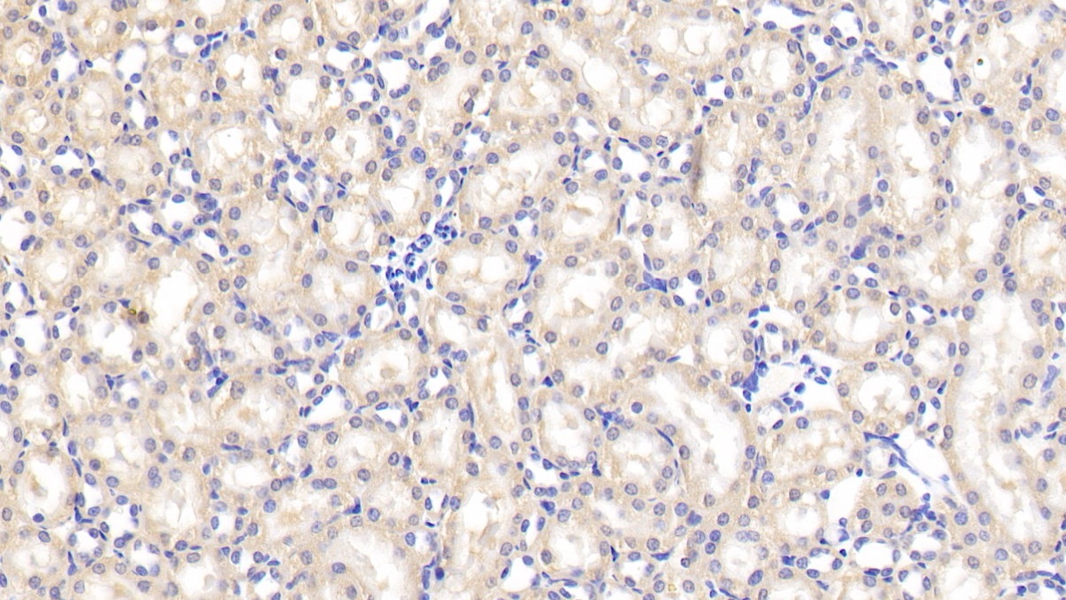 Polyclonal Antibody to Von Hippel Lindau Tumor Suppressor (vHL)