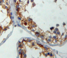 Polyclonal Antibody to Cbp/p300 Interacting Transactivator, With Glu/Asp Rich Carboxy Terminal Domain 1 (CITED1)