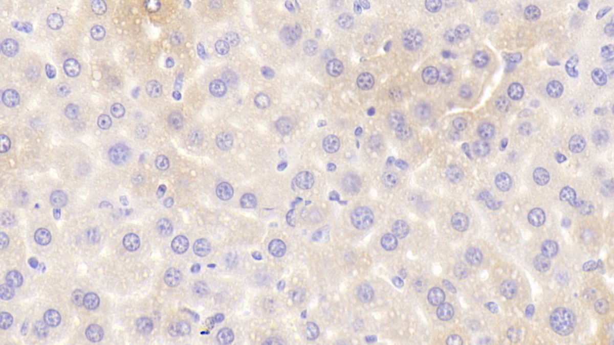 Polyclonal Antibody to Hydroxyacyl Coenzyme A Dehydrogenase Beta (HADHb)