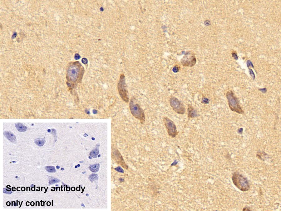 Polyclonal Antibody to A Disintegrin And Metalloprotease 15 (ADAM15)