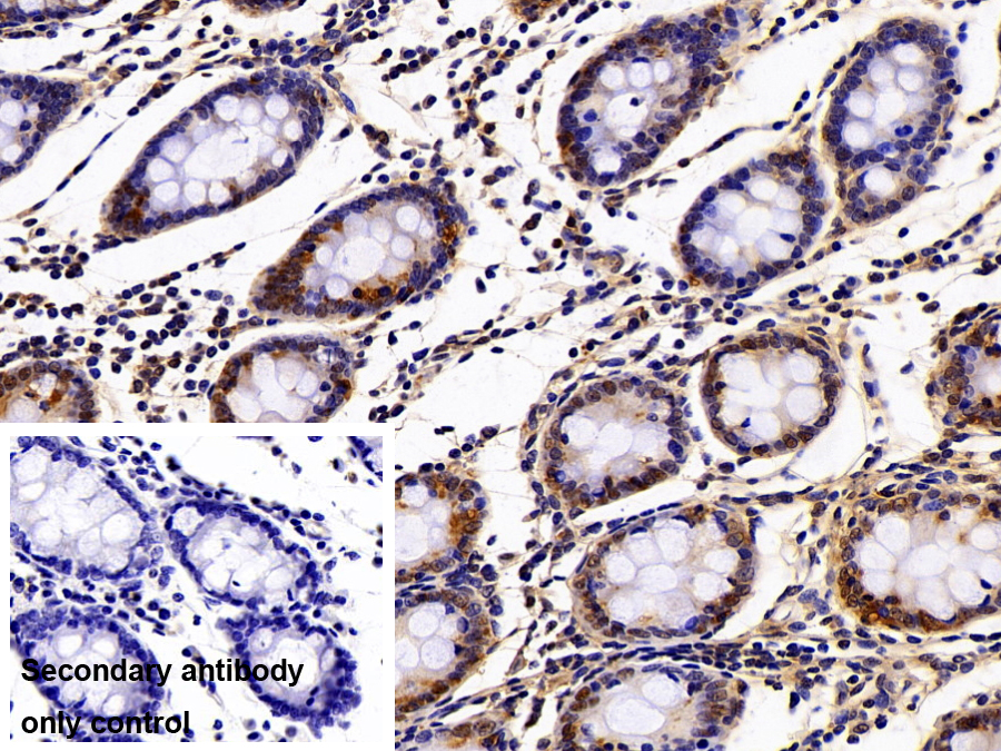 Polyclonal Antibody to Tyrosine 3/Tryptophan 5 Monooxygenase Activation Protein Zeta (YWHAz)