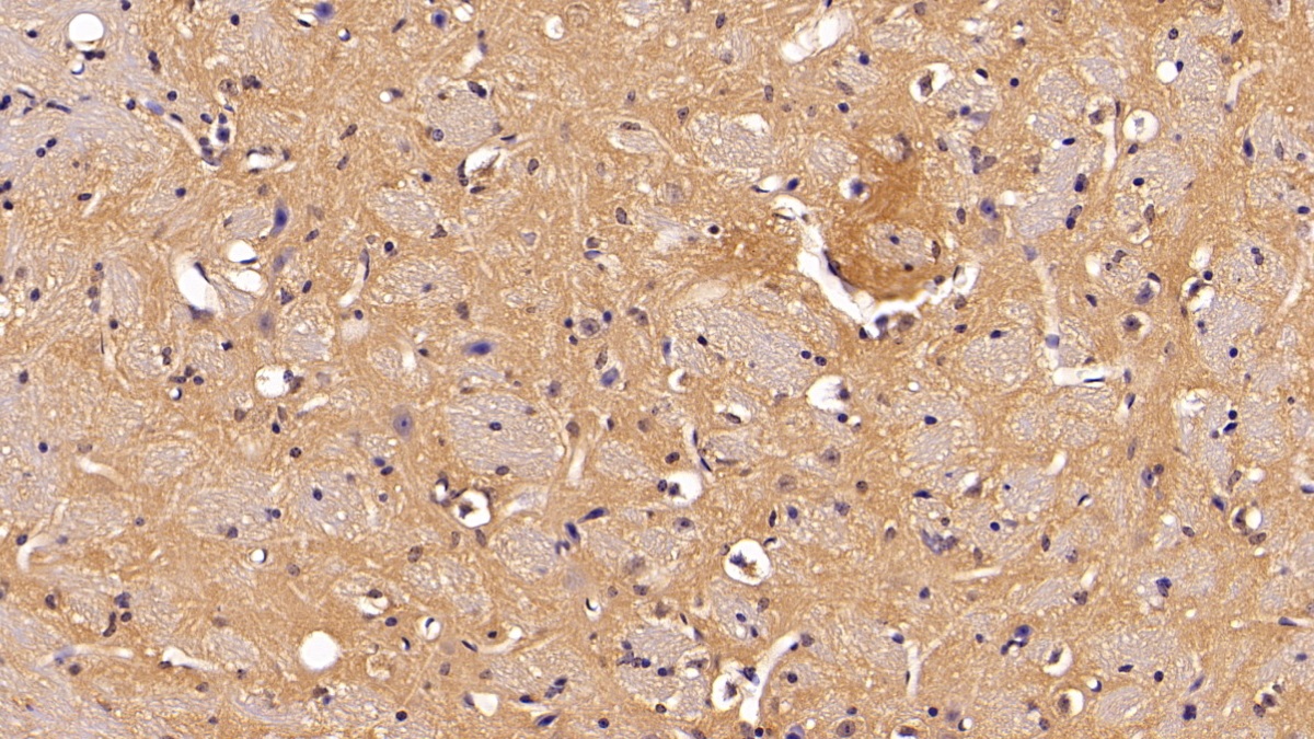 Polyclonal Antibody to Non Metastatic Cells 2, Protein NM23B Expressed In (NME2)