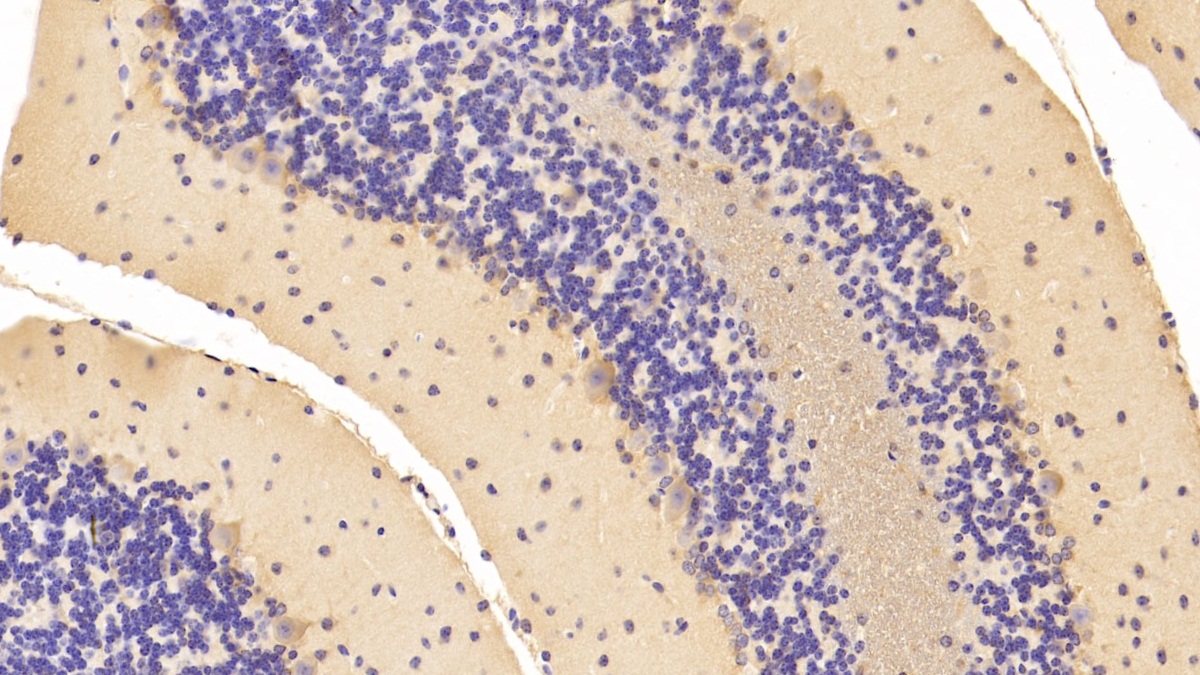 Polyclonal Antibody to Non Metastatic Cells 1, Protein NM23A Expressed In (NME1)