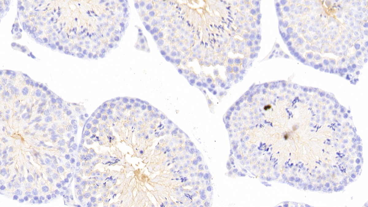 Polyclonal Antibody to Inhibitor Of Kappa-Light Polypeptide Gene Enhancer In B-Cells Kinase Beta (IkBKb)