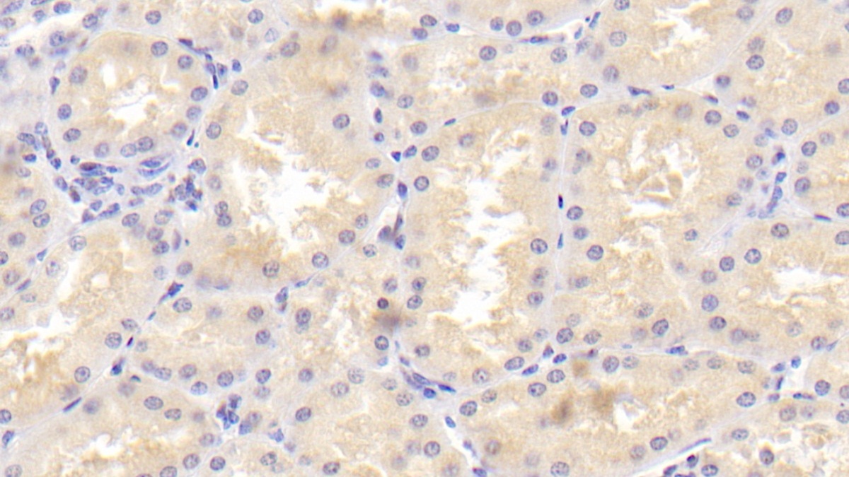 Polyclonal Antibody to TRAF Family Member Associated NFKB Activator (TANK)