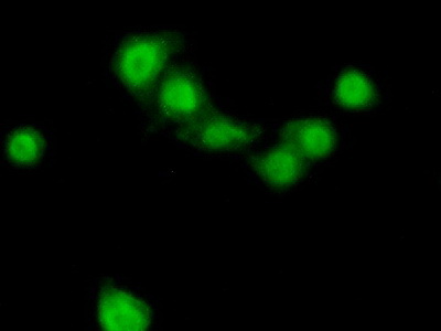 Polyclonal Antibody to Phosphoinositide-3-Kinase Catalytic Beta Polypeptide (PIK3Cb)