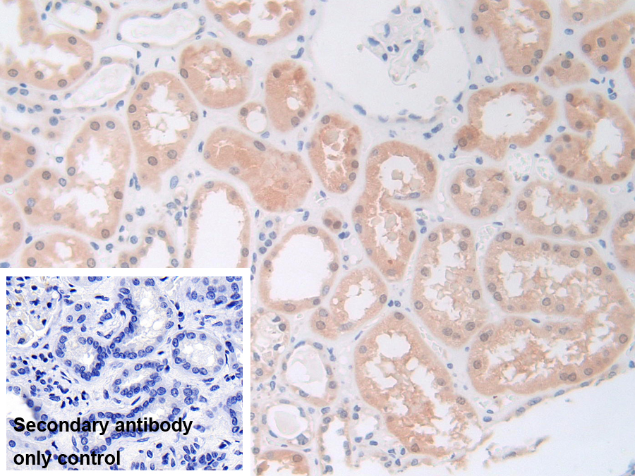 Polyclonal Antibody to Phosphoinositide-3-Kinase Catalytic Beta Polypeptide (PIK3Cb)