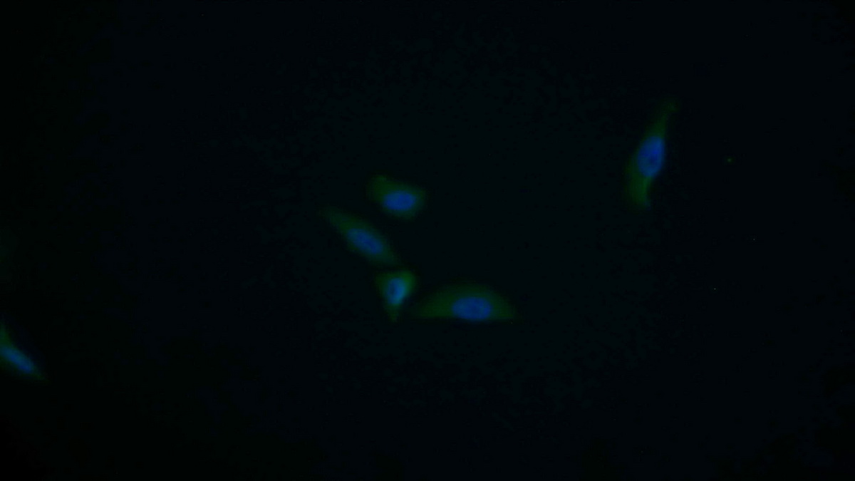 Polyclonal Antibody to Phosphoinositide-3-Kinase Adaptor Protein 1 (PIK3AP1)