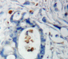 Polyclonal Antibody to F-Box And WD Repeat Domain Containing Protein 7 (FBXW7)