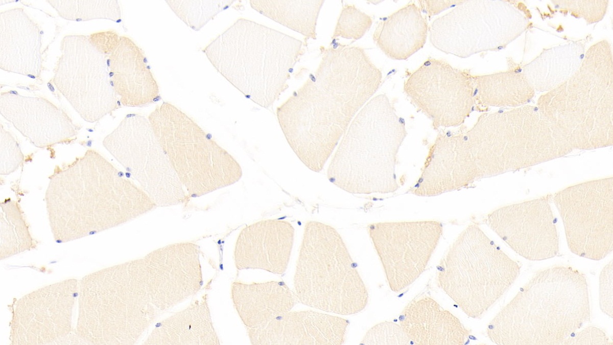 Polyclonal Antibody to Coiled Coil Domain Containing Protein 80 (CCDC80)