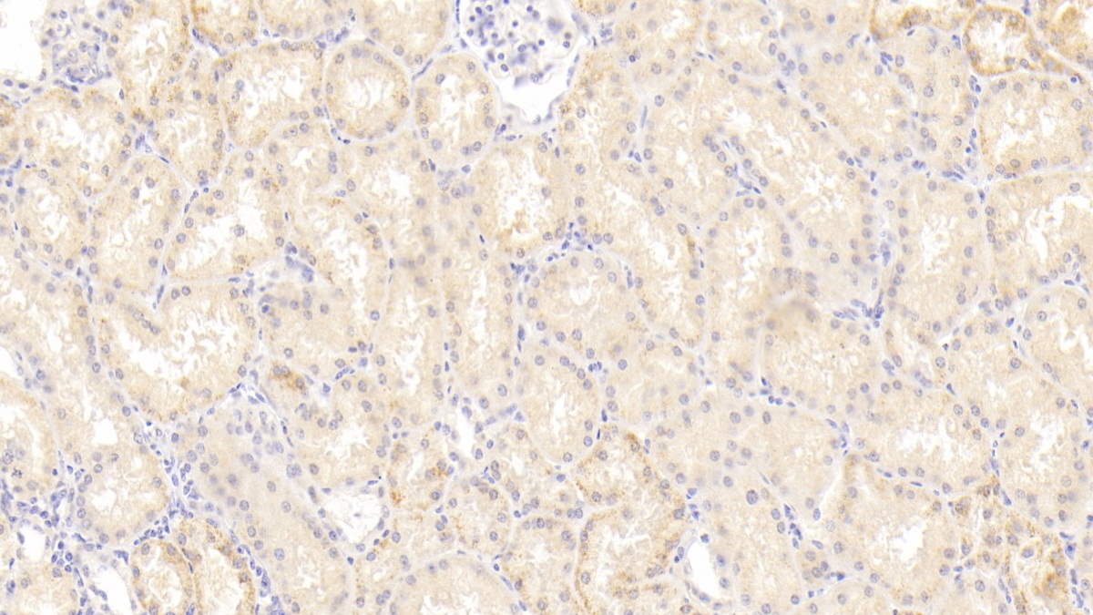 Polyclonal Antibody to Numb Homolog (NUMB)