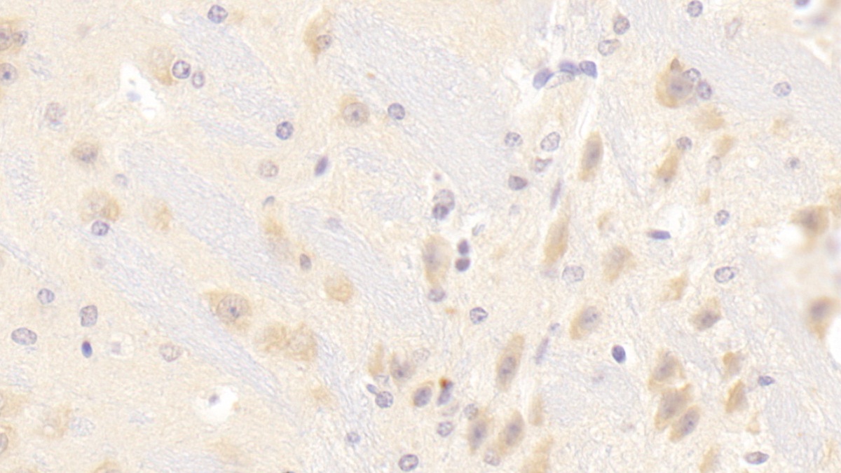 Polyclonal Antibody to Numb Homolog (NUMB)