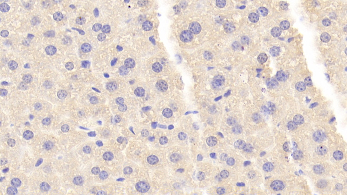 Polyclonal Antibody to Carnosine Synthase 1 (CARNS1)