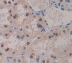 Polyclonal Antibody to Meiotic Recombination 11 Homolog A (MRE11A)