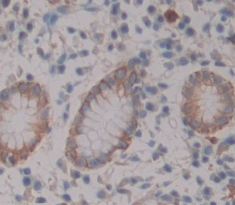 Polyclonal Antibody to A Disintegrin And Metalloprotease 28 (ADAM28)