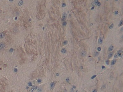 Polyclonal Antibody to A Disintegrin And Metalloproteinase With Thrombospondin 2 (ADAMTS2)