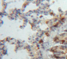 Polyclonal Antibody to A Disintegrin And Metalloproteinase With Thrombospondin 8 (ADAMTS8)