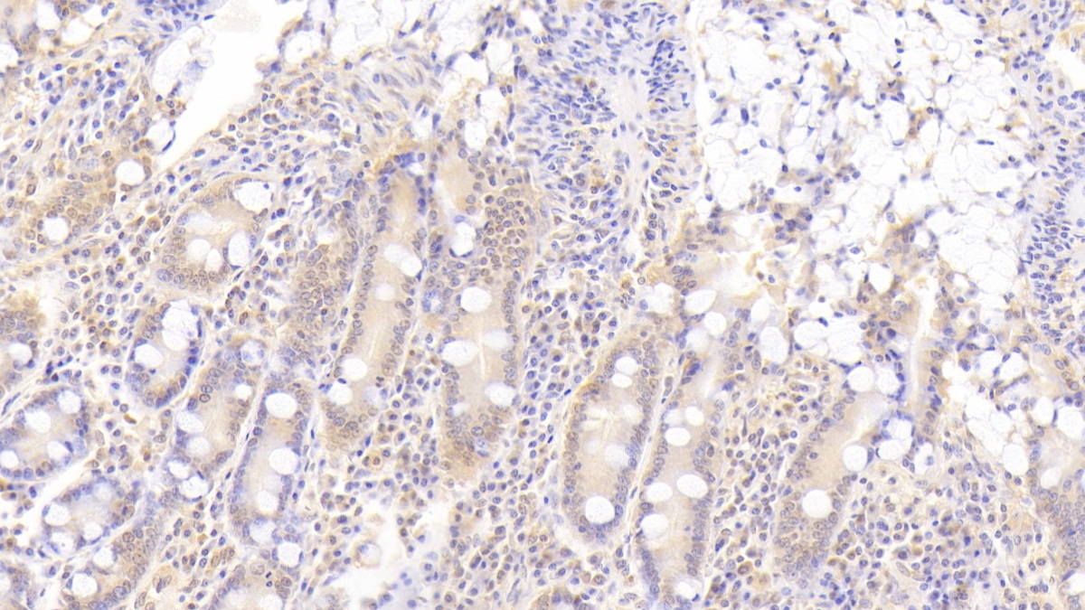 Polyclonal Antibody to A Disintegrin And Metalloproteinase With Thrombospondin 9 (ADAMTS9)