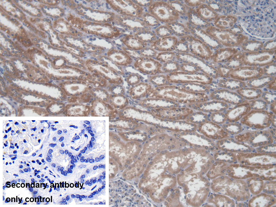 Polyclonal Antibody to Non Metastatic Cells 5, Protein NM23A Expressed In (NME5)