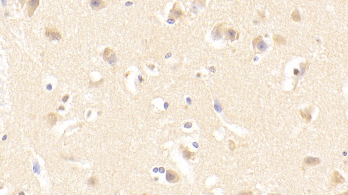 Polyclonal Antibody to FYN Oncogene Related To SRC/FGR/YES (FYN)