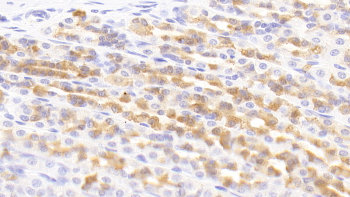 Polyclonal Antibody to O-Fucosylpeptide-3-Beta-N-Acetylglucosaminyltransferase (RFNG)