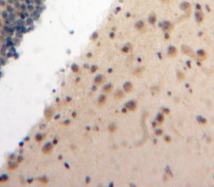 Polyclonal Antibody to Ataxia Telangiectasia And Rad3 Related Protein (ATR)